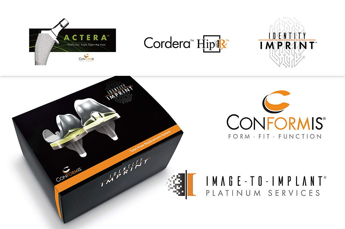 Thsi image ahwo rthe different logo's under the Conformis unbrella. Actera, Cordea hit Rx and Identity Imrint